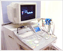 超音波画像診断装置